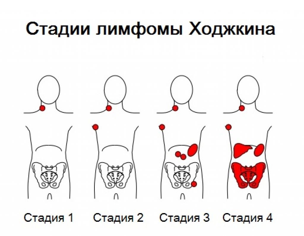 Oepa лимфома схема